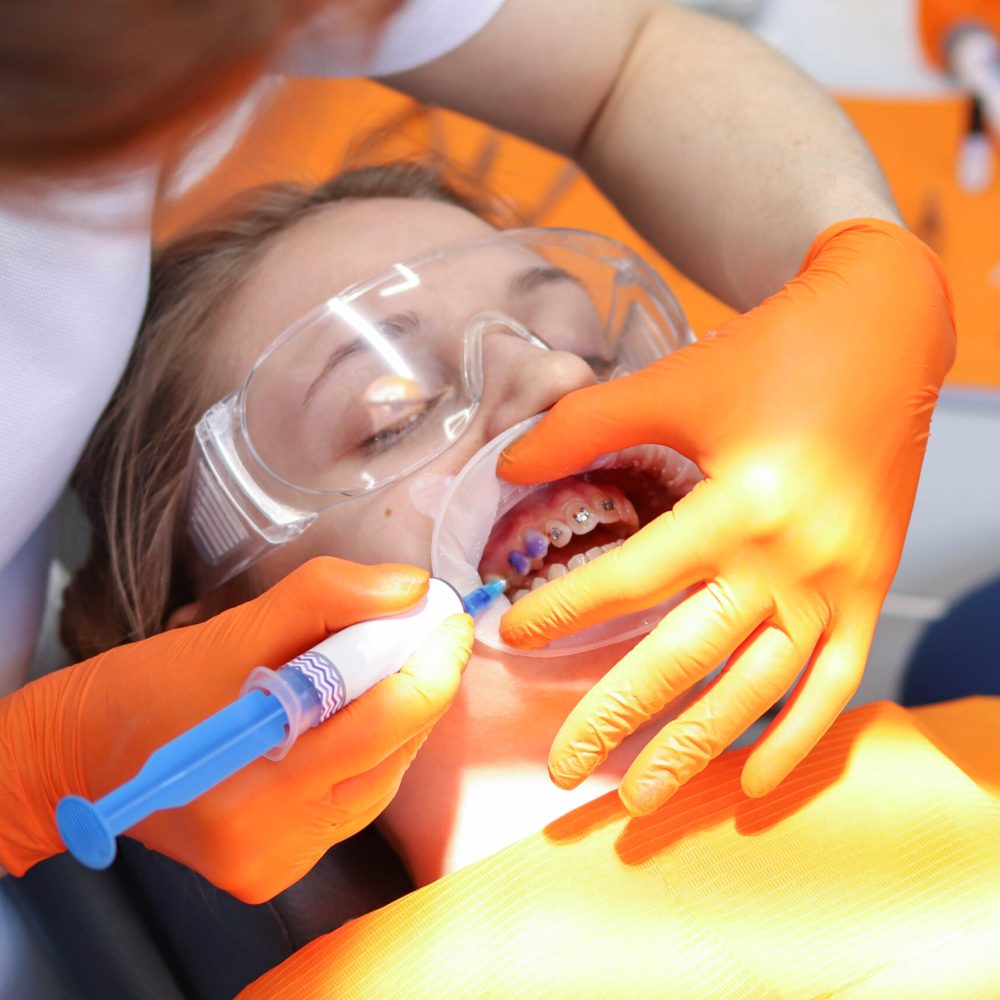 Dentist's doctor installs dental braces for his patient